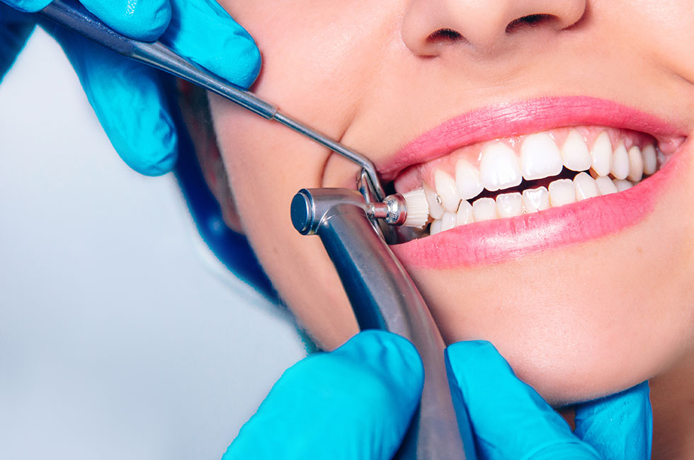 teeth-cleaning-dental-service